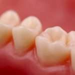 Десна отошла от зуба: причины и методы лечения