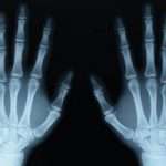 Знаете ли вы о том, как часто можно делать рентген и опасно ли это для человека