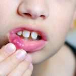 Таблетки "Фарингосепт" для детей: инструкция по применению, отзывы