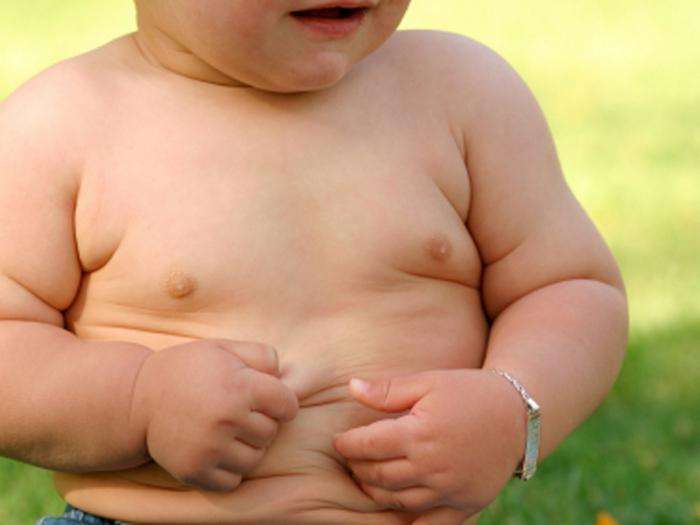 ожирение у детей фото 
