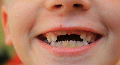 во сколько лет выпадают молочные зубы