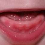 Может ли быть кашель при прорезывании зубов: причины, методы лечения и рекомендации врачей