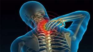 Шейный остеохондроз: симптомы, причины, варианты лечения, лечебная гимнастика, массаж, отзывы