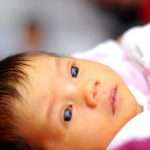 Желтые белки глаз у новорожденного: причины, описание с фото, возможные проблемы и рекомендации педиатров