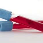 Расшифровка анализа крови: особенности, основные показатели и норма