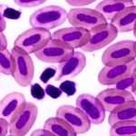 Как повысить содержание лейкоцитов в крови