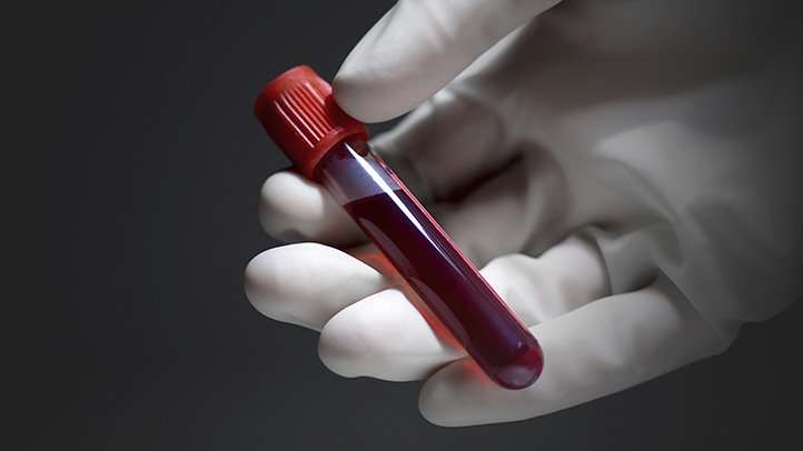 Расшифровка анализа крови
