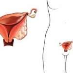 Основные признаки рака матки