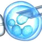 Почему после переноса эмбрионов тянет живот и поясницу