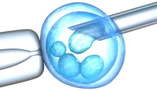 Тянет живот после переноса эмбриона 2 день