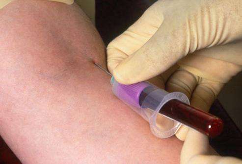 Что такое клинический анализ крови