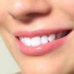 Процедура отбеливания зубов: отзывы и рекомендации