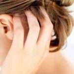 Причины, симптомы и лечение себорейного дерматита на голове