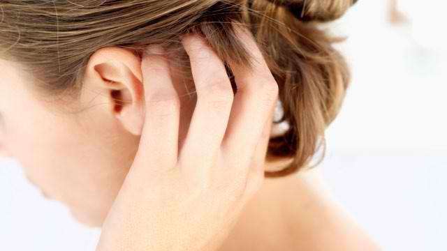лечение себорейного дерматита на голове 