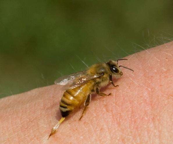 что делать при укусе пчелы