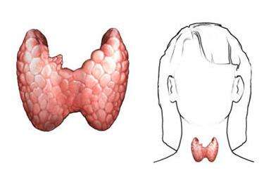 гипертиреоз щитовидной железы