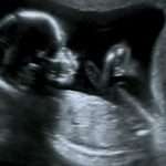Живот на 6 месяце беременности: фото, ощущения, анализы