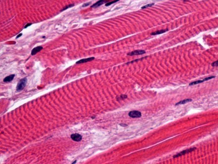 мышечная ткань человека поперечно полосатая