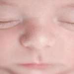 Что такое милии у новорожденных: описание, фото и рекомендации по лечению