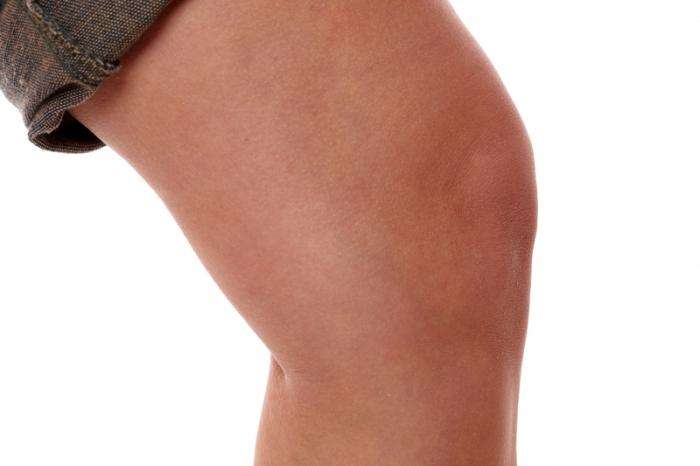 лечение синовита коленного сустава
