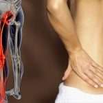 Боли в спине, отдающие в ногу: причины, лечение