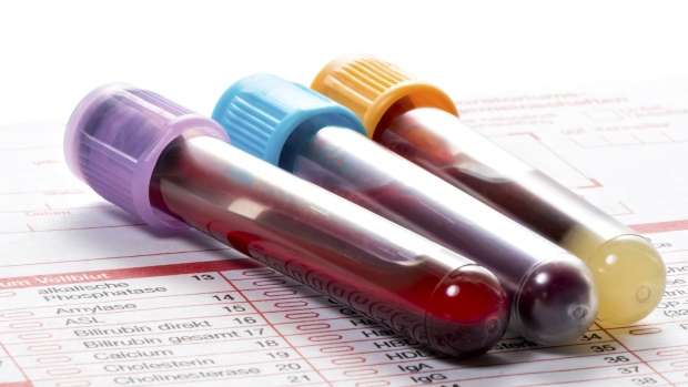 биохимический анализ крови при беременности