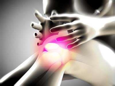 артрит коленного сустава симптомы 