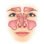 Искривление носовой перегородки: операция и лечение