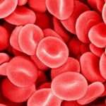 Вас беспокоит густая кровь: причины и лечение