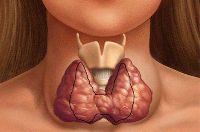 какие заболевания щитовидной железы