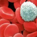 О чем свидетельствуют пониженные лейкоциты?